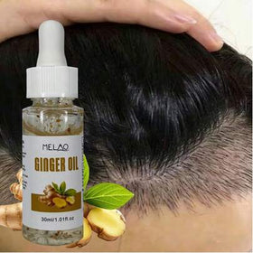 زيت زنجبيل أساسي MELAO، يحتوي على مستخلص زنجبيل طبيعي خالص، يغذي فروة الرأس ويضيف لمعان وليونة وقوة للشعر، 30 مل / 1.01 أونصة سائلة، مع قطارة